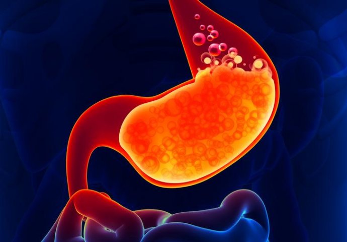 Hrana koja razara želudac: Ove namirnice izbjegavajte prije spavanja!