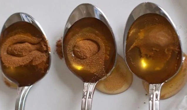 MED I CIMET – JAKO MOĆNA KOMBINACIJA: Protiv virusa i srčanih bolesti, artritisa, infekcije žučnog mjehura, želučanih tekoba…