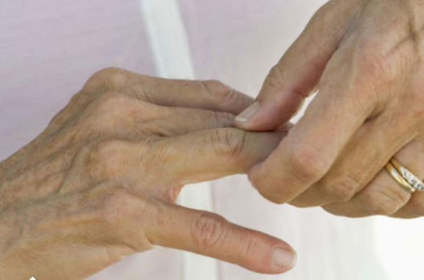 Kosti ne vole ovu hranu: Ako je konzumirate, bol će biti pojačana, artritis će se pogoršati, a zglobovi će se dodatno trošiti...