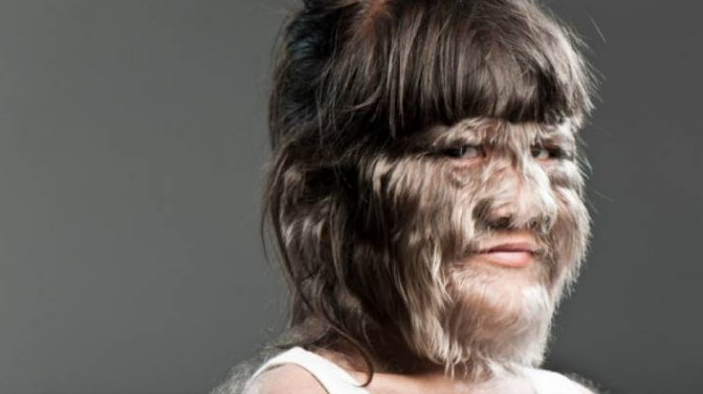 Udala se najdlakavija žena na svijetu, pogledajte kako izgleda!