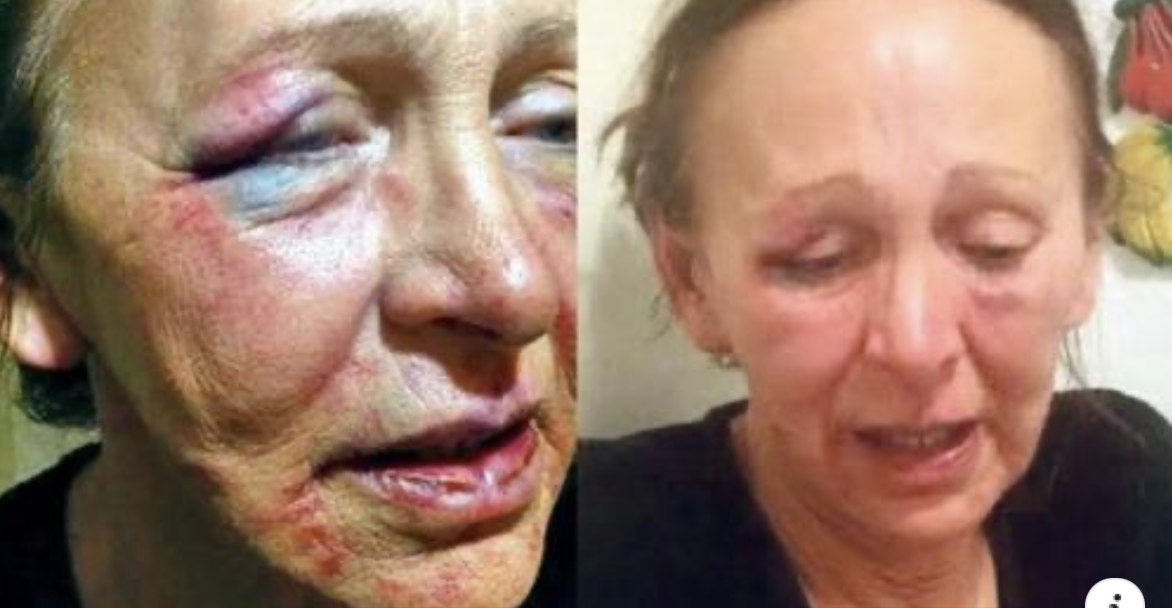 MAJKA PREKIDA SVE ODNOSE SA SVOJIM NASLJEDNIKOM: Agresivno me napao, prijetio gušenjem i nasilno me oborio!