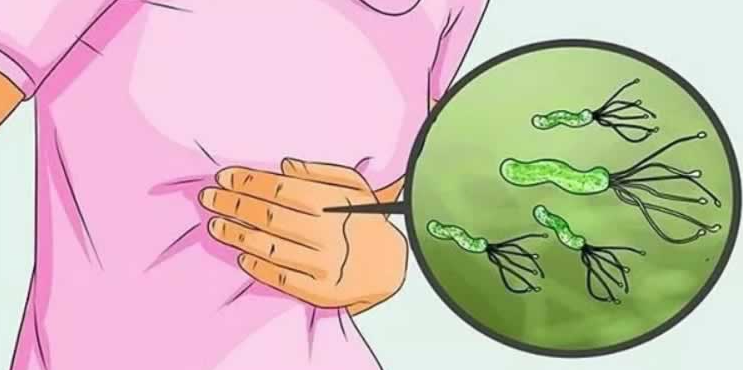Uz pomoć ove mješavine Helicobacter pylori nestaje u tren oka