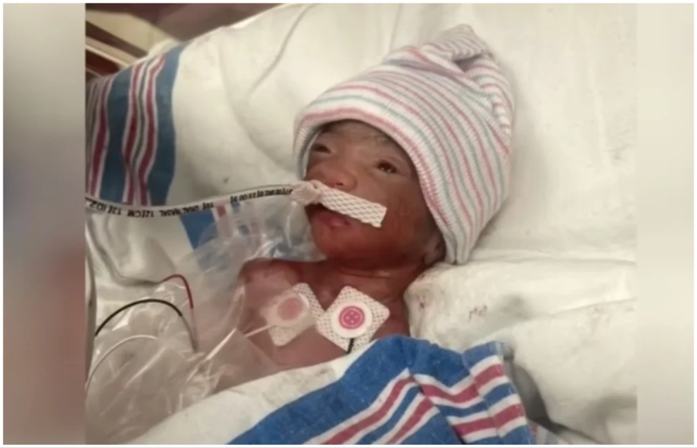 Nakon puno suza i molitvi, beba rođena s 455 g odlazi kući nakon gotovo 500 dana u bolnici