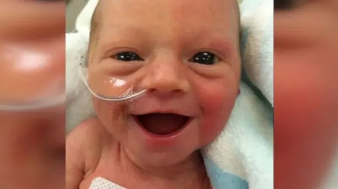 PREDIVNA SLIKA NASMIJEENE PRERANO ROĐENE BEBE DAJE NADU RODITELJIMA DILJEM SVIJETA