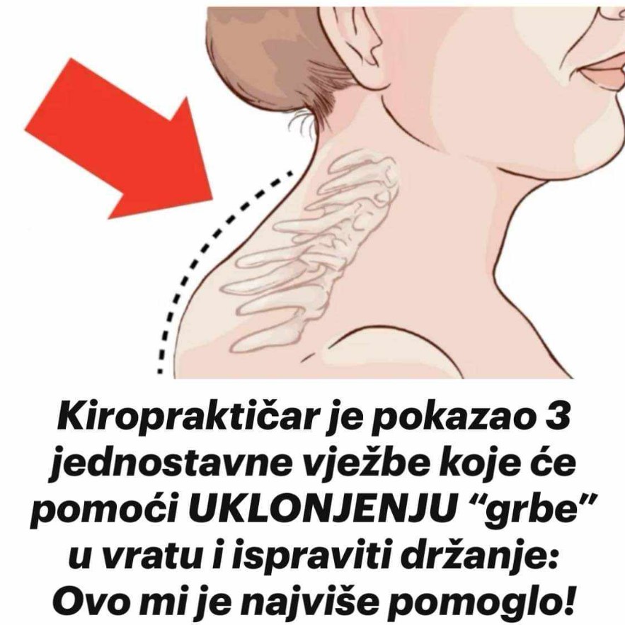 Kako Ublažiti Bolove u Vratnoj Kičmi: Vježbe za Ispravljanje Držanja