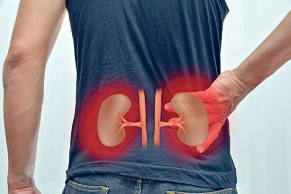 RAK BUBREGA JE NAJTEŽE OTKRITI: Ovo Mogu Biti Najraniji Znaci Da Tijelo Razara Ova Opaka Bolest!