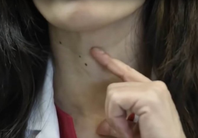 NAGLO STE SE UGOJILI, UMORNI STE I RAZDRAŽLJIVI: Hitno uradite ovih 5 analiza, one govore da ŠTITNA ne radi kako treba