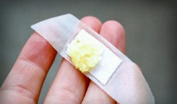 Razlog će vas iznenaditi: Komad bijelog luka stavite na flaster i zalijepite na kožu