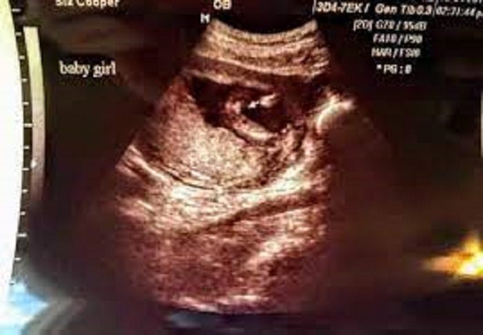 Trudnica otišla na pregled, kad je doktor vidio ULTRAZVUK odjednom je zašutio: NIJE ZNAO KAKO DA IM KAŽE ZA OVAJ SLUČAJ
