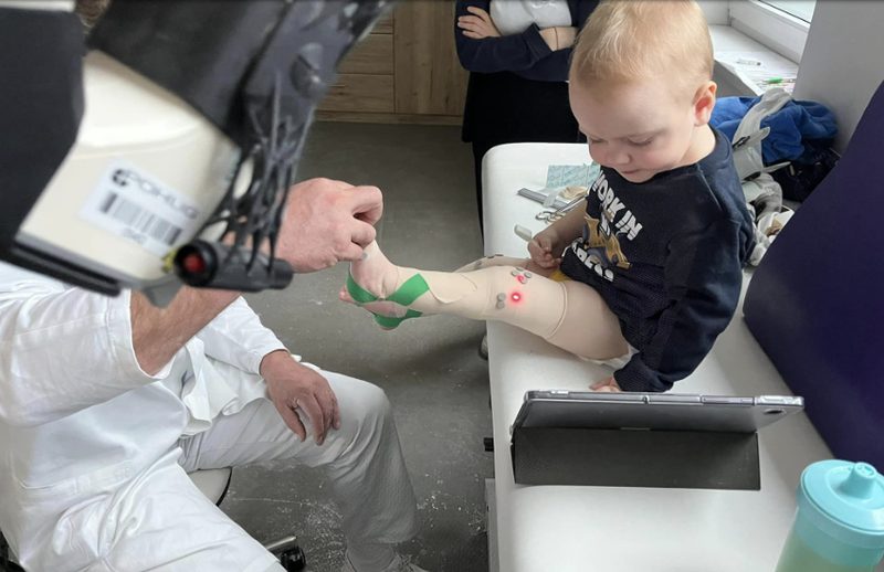 Nakon teških medicinskih nalaza i bolnih kirurških intervencija, dvogodišnji Tin iz Vinkovaca uspio je prohodati