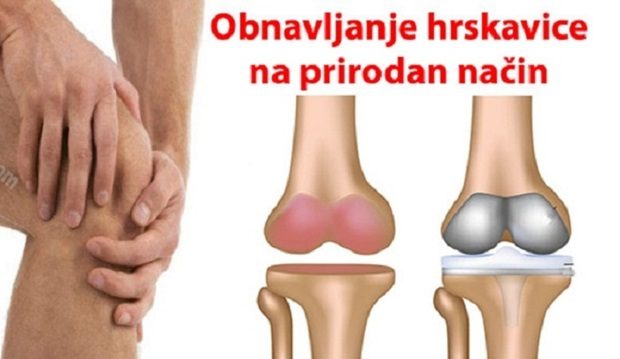 OBNOVITE KOSTI, TETIVE I ZGLOBOVE ZA NEDELJU DANA (RECEPT)
