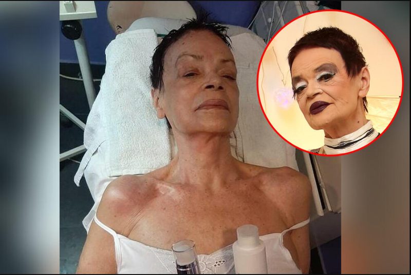 MEDIJSKA BURA ZBOG FOTOGRAFIJE KOJA KRUŽI DRUŠTVENIM MREŽAMA: Ruška Jakić skinula šminku i pokazala svoje PRAVO lice (FOTO)